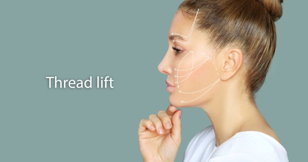 thread lift procedures