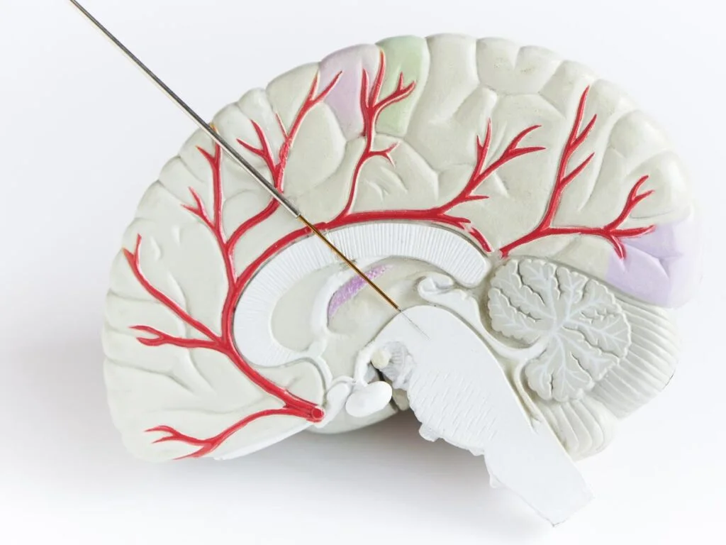 Etiology of Parkinson's Disease